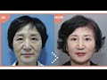 Dr. Oh Se Kwang (клиника OHKIMS) об искусстве врачевания и пластических операциях