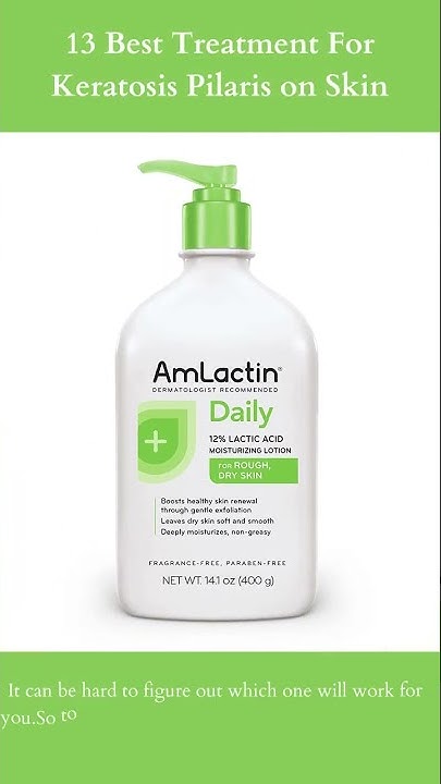 Amlactin Daily Moisturizing Body Lotion For Keratosis Pilaris 13 Best Treatment For Keratosis Pilaris on Skin | AmLactin Daily