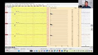 Download Mp3 BESA Research Workshop Tutorial 1C: FFT and DSA Gudang lagu Download Mp3 BESA Research Workshop Tutorial 1C: FFT and DSA
