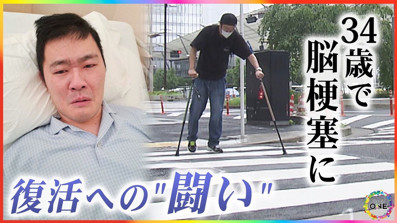 34歳 脳梗塞