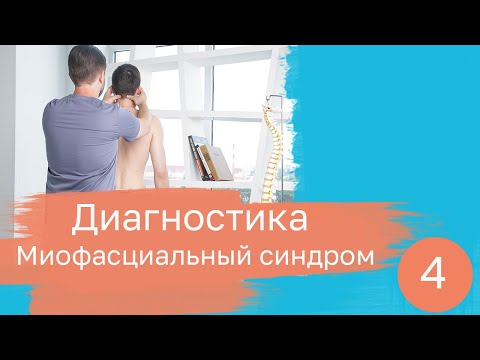 Миофасциальный синдром. Диагностика.