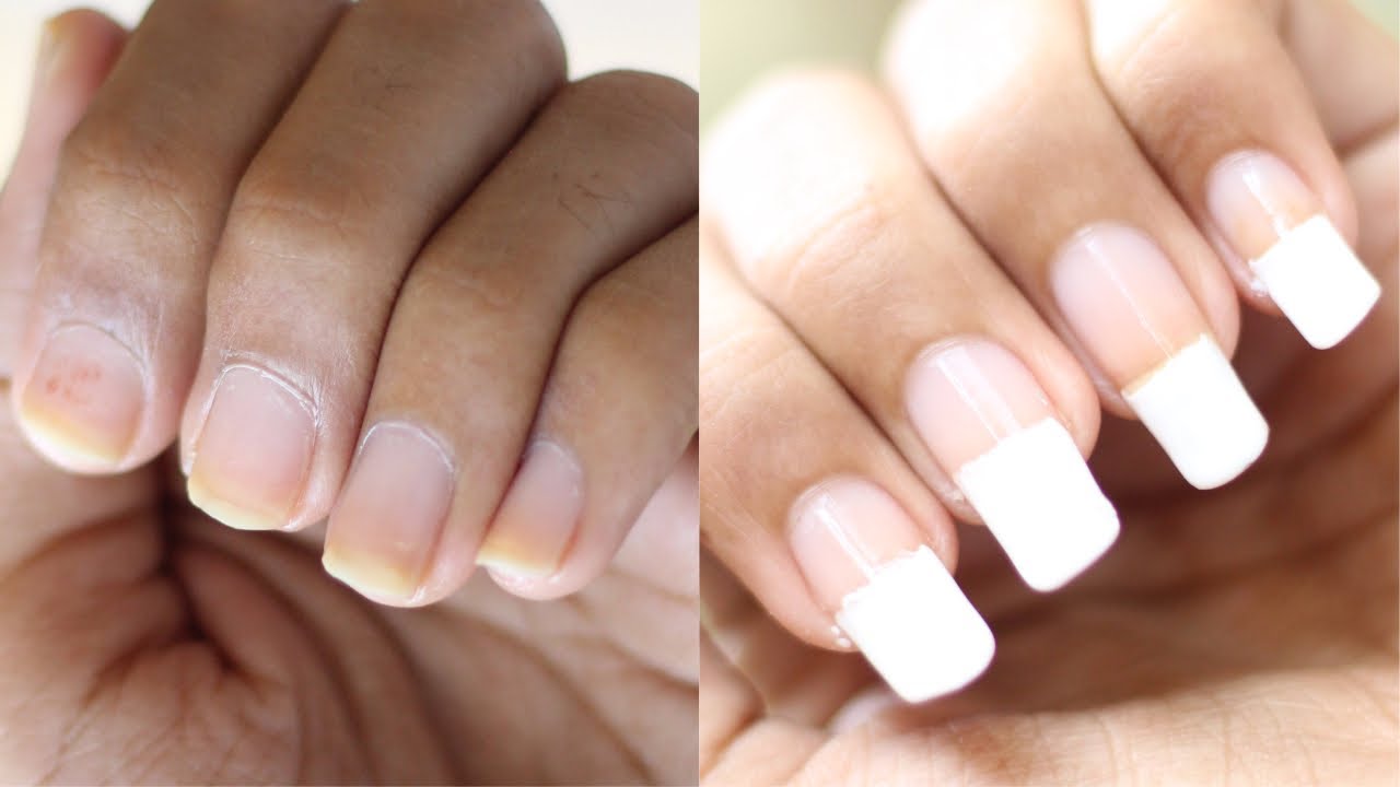 5 home remedies for nail growth | Holland & Barrett