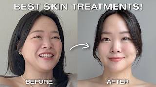 Top 3 Skin Treatments to Look Snatched & for Flawless Skin! | (WEIGHTLOSS❌ )
