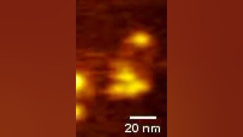 HS AFM imaging of condensin