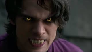 TeenWolf [6x16] Liam Almost Kills Nolan screenshot 3