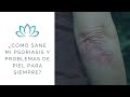 ¿Cómo sané mi Psoriasis y Problemas de Piel para siempre?