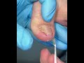 Gentle Toe Grooming | Fresh and Healthy Nail Look #toenailcare #pedicure #pedicureroutine #fypシ