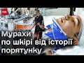 🤯 Всі органи відмовили, коли його затисло між плитами! Та медики зробили “неможливе”