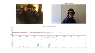 SMARTING EEG integrated with SMI Eye Tracking Glasses