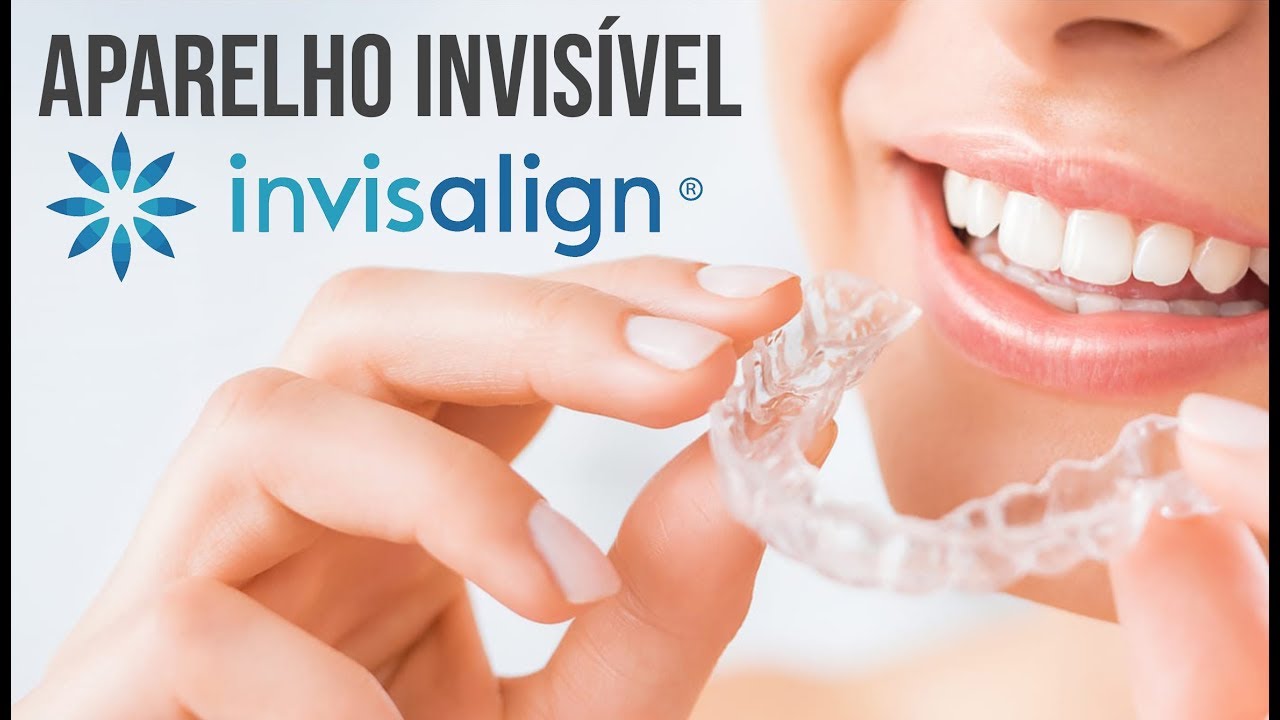 Como funciona el invisalign