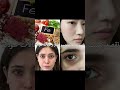 نقص الفيتامينات و تأثيرها على البشرة 🥨 #explore #اكسبلور #mia #selfcare