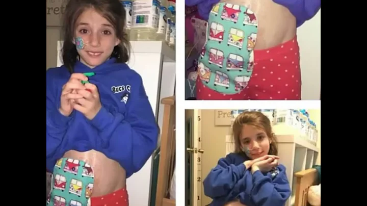 Video 1