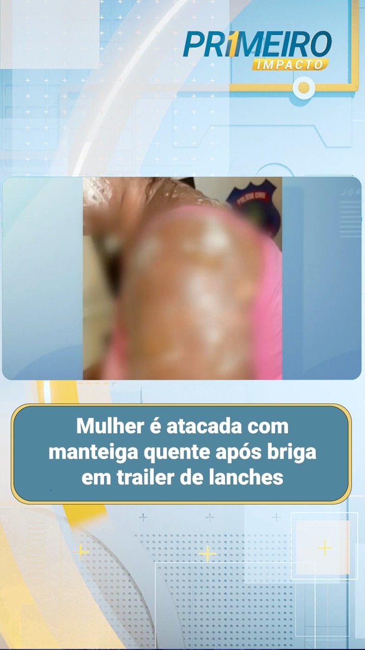 Mulher é atacada com manteiga quente após briga em trailer de lanches