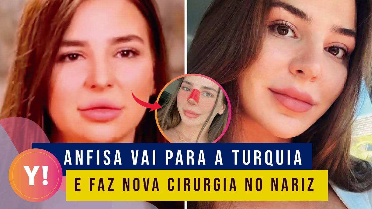 90 dias para casar anfisa