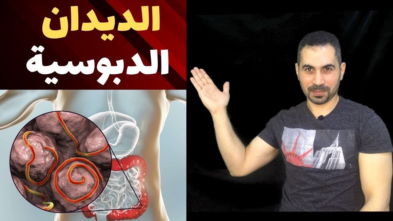الديدان الدبوسية والادوية المستخدمة في علاجها. pinworm infection