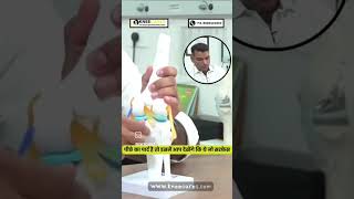 knee replacement surgery #ytshorts #shots #youtubeshorts #ytshort #aclinjury #aclrecovery #acl