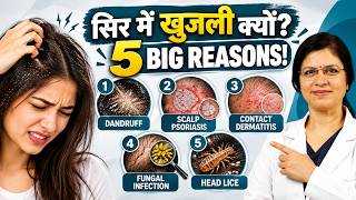 सिर में बार-बार खुजली क्यों होती है? | 5 बड़े कारण जो आपको जानना जरूरी है | Doctor Explains