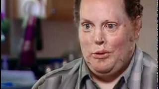 WTC's "Unlimited Potential" - Wounded Soldiers showcase their abilities