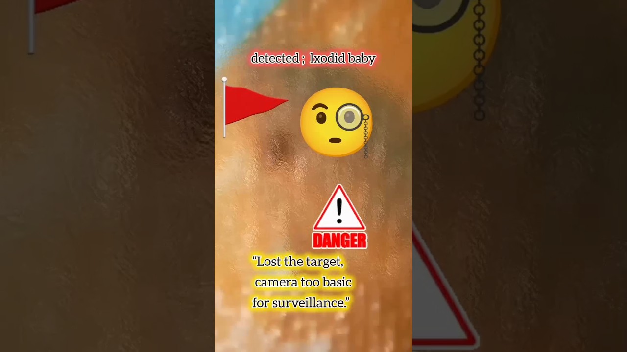 “Lost the target, camera too basic for surveillance.” ixodid attact 