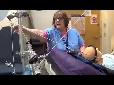 Boston Children's Hospital | Halo Traction Bed Set Up | May 2015 - YouTube