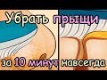 Как Избавиться от Прыщей, Угрей и Черных точек за 10 минут [Быстрый способ избавиться от прыщей]