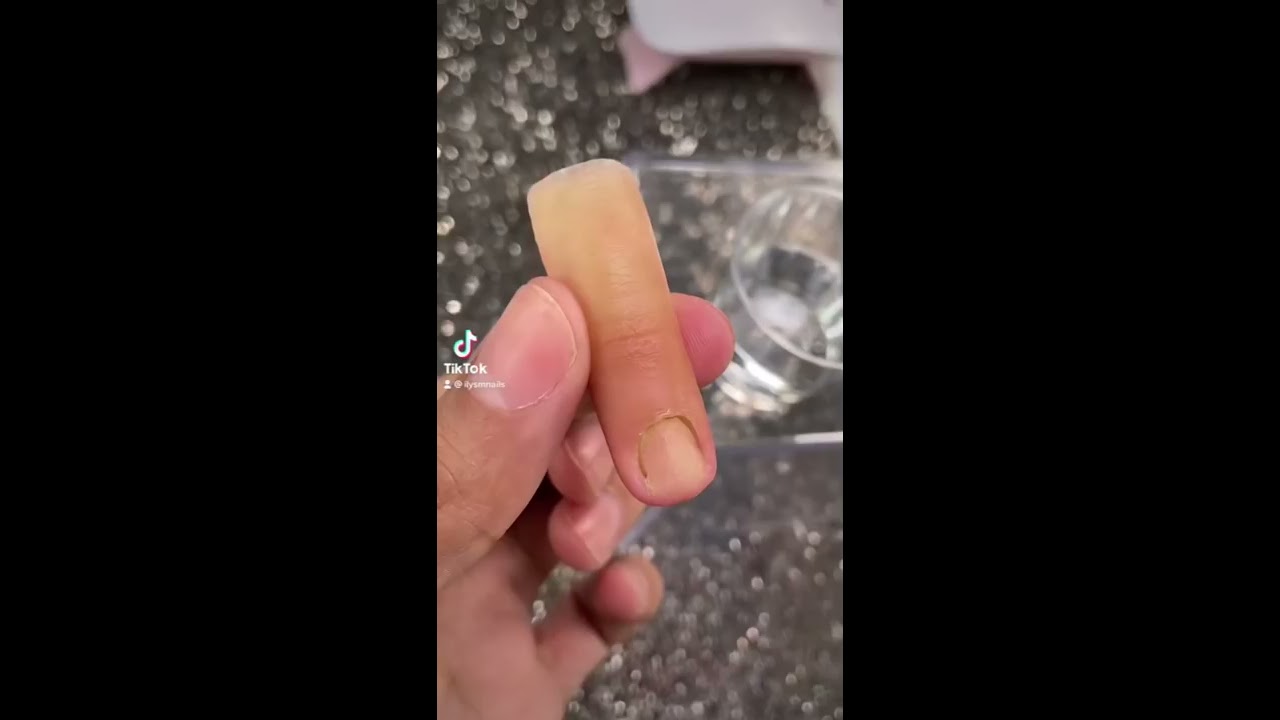 Prosthetic Finger Application  Removal amputeebarbie created this Beautiful Detailed Finger