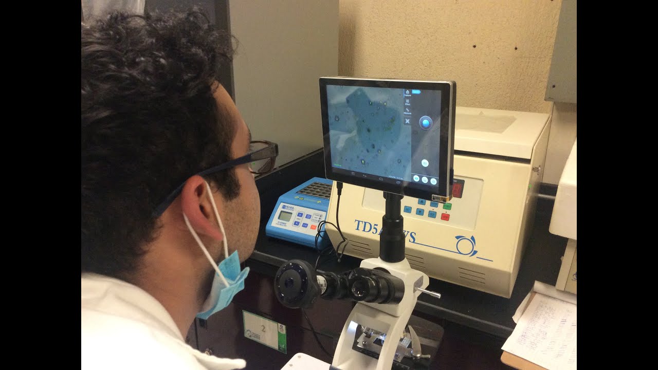 Coliformes totales y fecales.