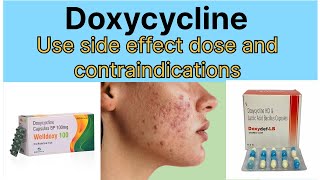 Doxycycline Tablet use in hindi ||Doxycycline dose side effect ||Doxycycline contraindications