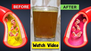 Take This in the Morning Before Breakfast &amp; Clean Clogged Arteries and Control High Blood Pressure