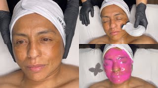 ASMR ANTIAGING FACIAL WITH CHEMICAL PEEL FOR HYPERPIGMENTATION FEAT. NUFACE MICROCURRENT DEVICE