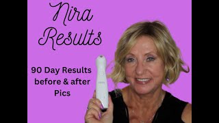 NIRA Results Update 96 Day Results | Monika's Beauty & Lifestyle