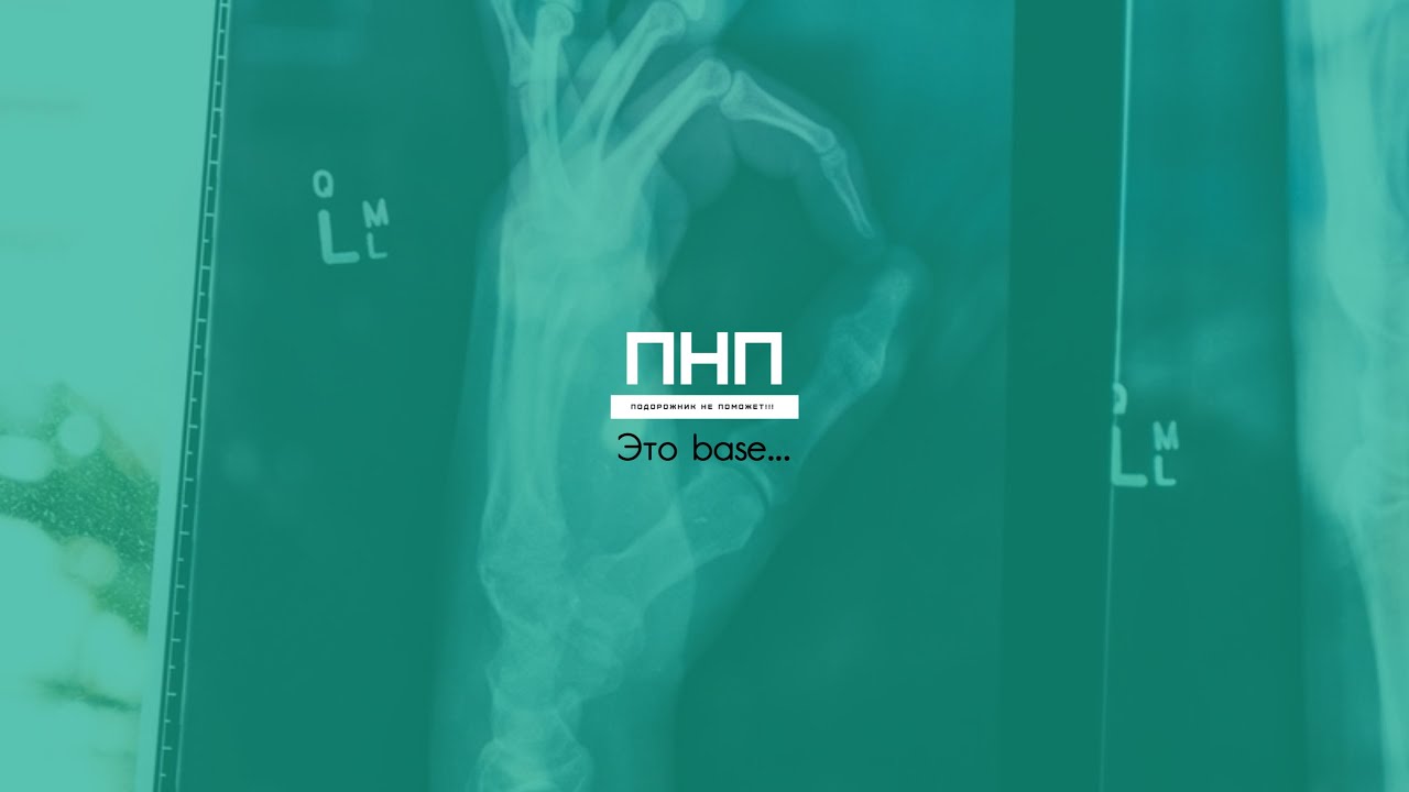 Подорожник не поможет - Это base... - YouTube