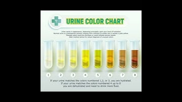 Urine Color Chart!!!#medical #doctor #heart