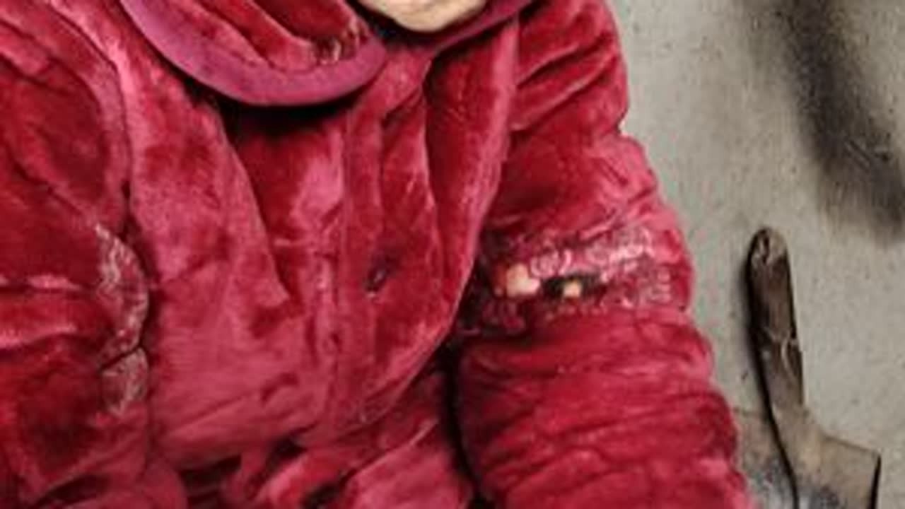 #阿尔兹海默症娘一天不如一天了