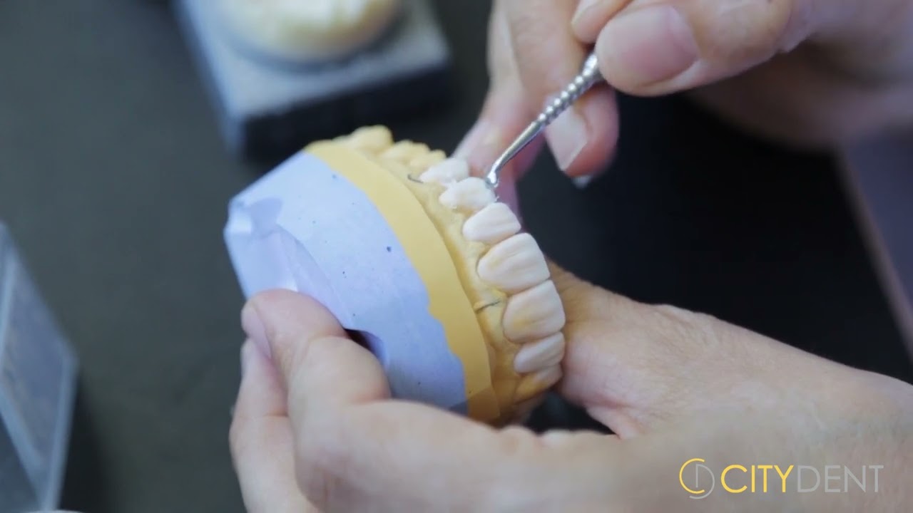 Crowns Veneers Istanbul Dental Clinic Citydent YouTube