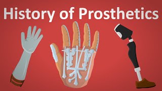 The History Of Prosthetics Explained