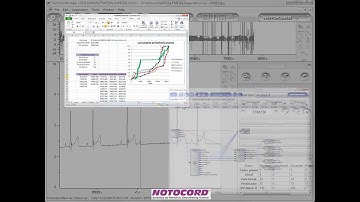 Cardiac arrhythmia detection with NOTOCORD-hem software