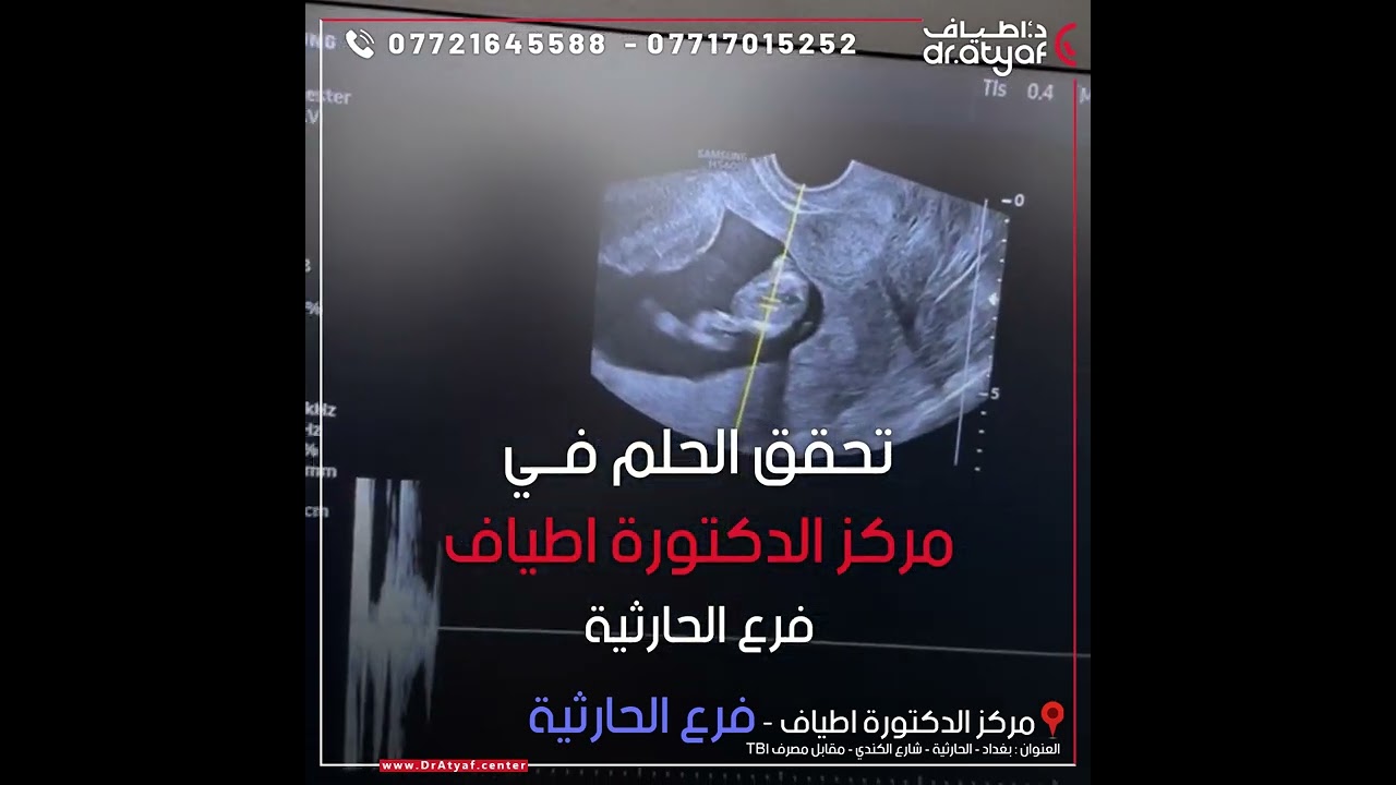حامل اطفال انابيب بعد انتظار ٨ سنوات - مراكز الدكتورة اطياف ( فرع الحارثية )