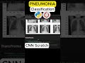 Chest X-Ray AI | Pneumonia Detection using CNN #computervision #deeplearning #coding #programming