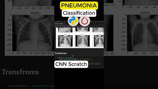 Chest X-Ray AI | Pneumonia Detection using CNN #computervision #deeplearning #coding #programming