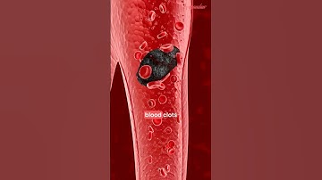 Atrial Fibrillation Explained | ECG | Afib Treatment | Management
