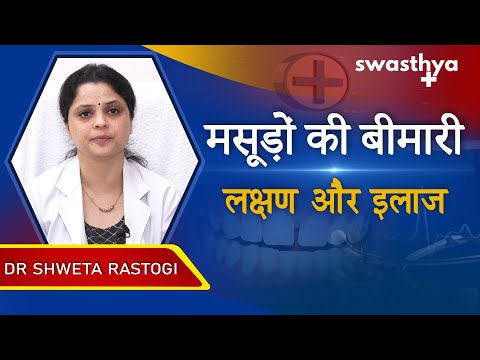 मसूड़ों की बीमारी - लक्षण और इलाज | Dr Shweta Rastogi on Symptoms & Treatment of Gums Disease