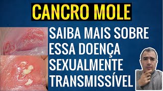 Cancro Mole: Aprenda mais sobre essa Doença Sexualmente Transmissível