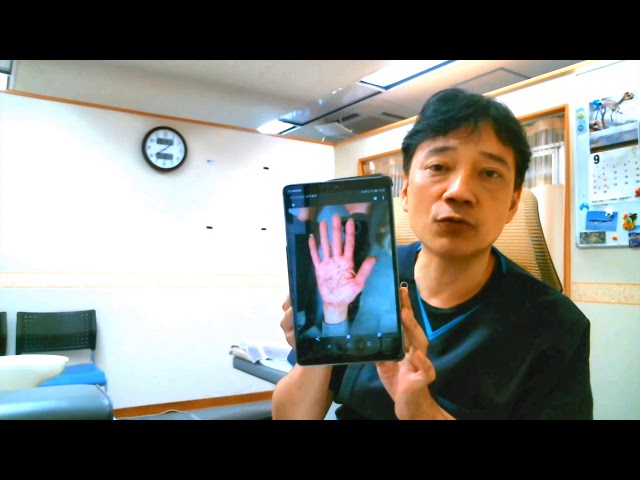 医師解説：掌蹠膿疱症とビオチン療法、本当のところ - YouTube