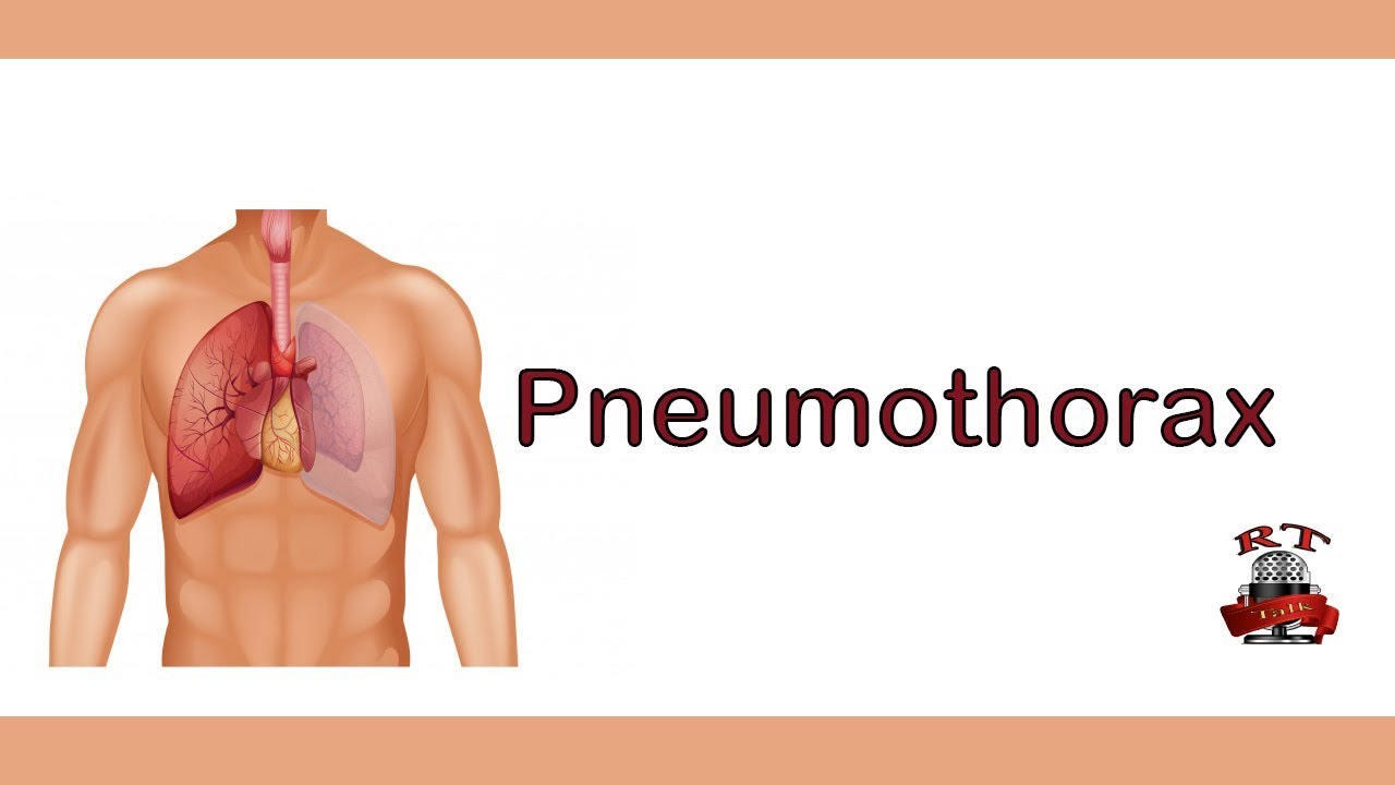 what is pneumothorax? ماهو الاسترواح الصدري