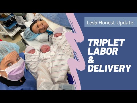 Triplet Labor and Delivery story