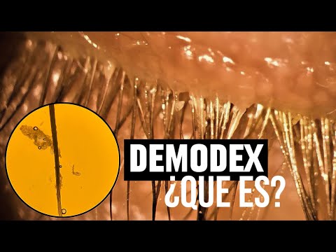 DEMODEX 🐛| The mite that lives in your eyelashes. Dr. Natalia Ramón