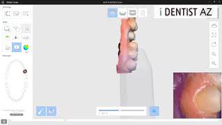 i500 Medit Intraoral Scaning