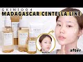 Daily Soothing skin care routine for sensitive skin with SKIN1004 MADAGASCAR CENTELLA Line