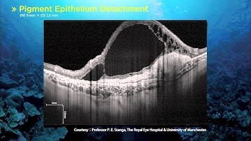 Topcon DRI OCT-1 ATLANTIS Swept Source OCT